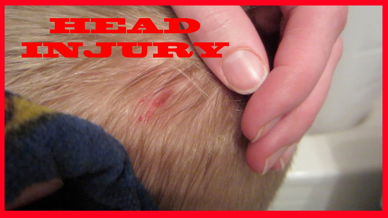 Emergency Head Injury | Easter Weekend 2 | Daily Vlog 402